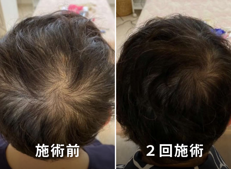 ビフォーアフター