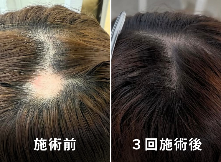 ビフォーアフター