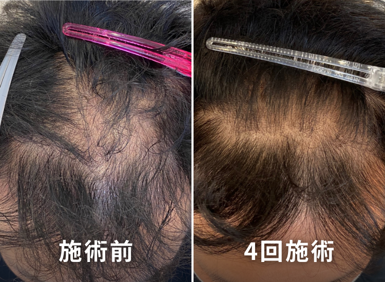 ビフォーアフター