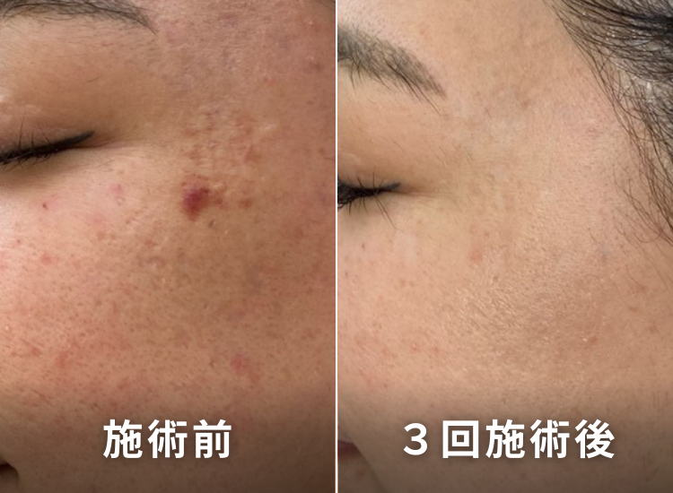 ビフォーアフター