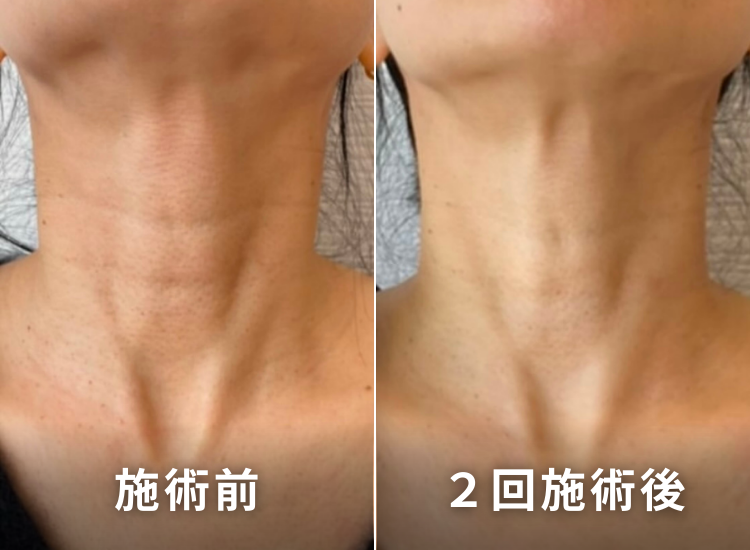 ビフォーアフター