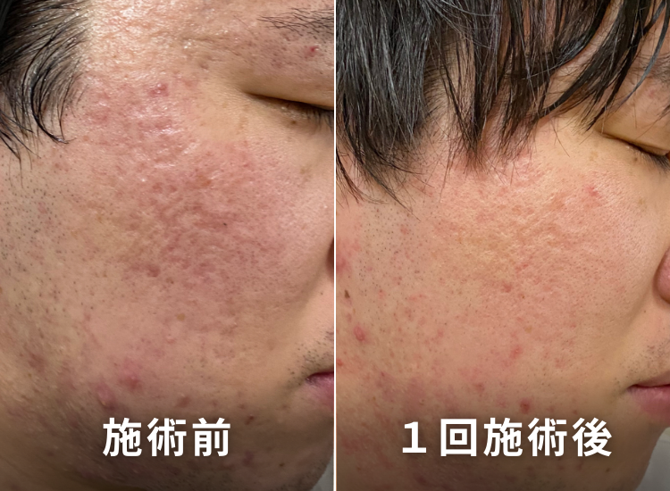 ビフォーアフター