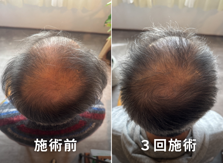 ビフォーアフター