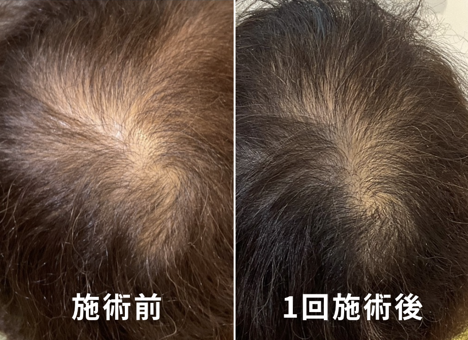 ビフォーアフター