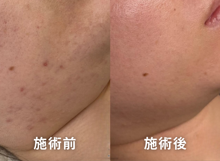 肌ビフォーアフター1