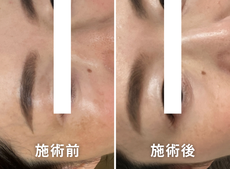 肌ビフォーアフター5