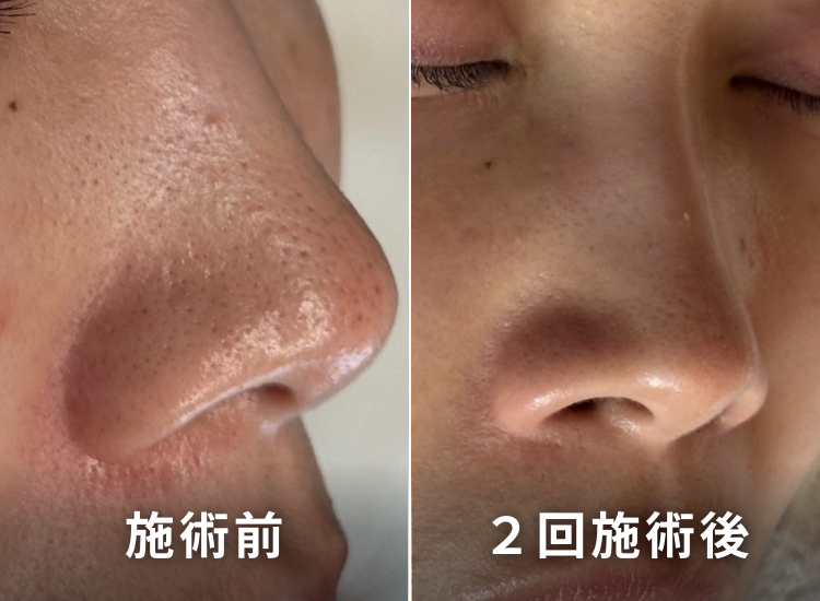 肌ビフォーアフター3