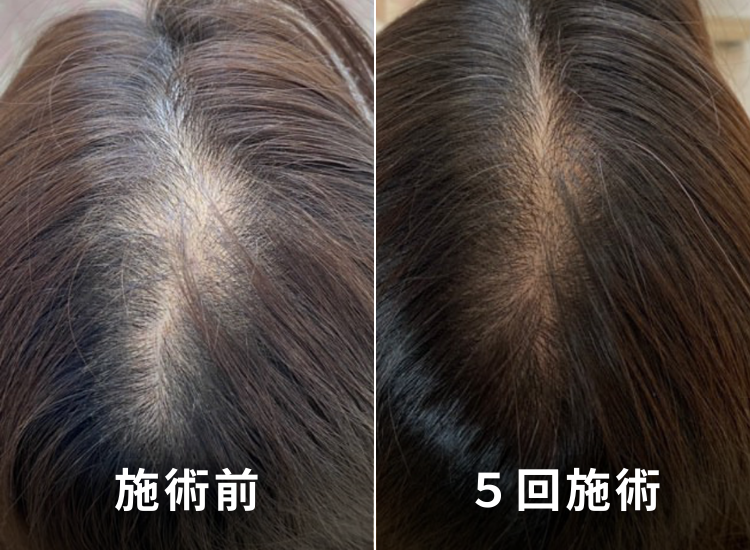 ビフォーアフター写真